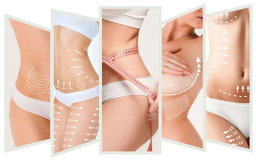 SmoothShapes Cellulite Treatment - Innovations Medical