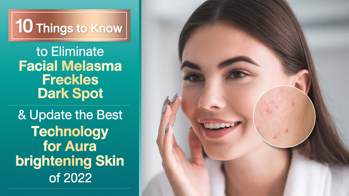 Dark Spots on Face (Melasma): Causes and Treatment