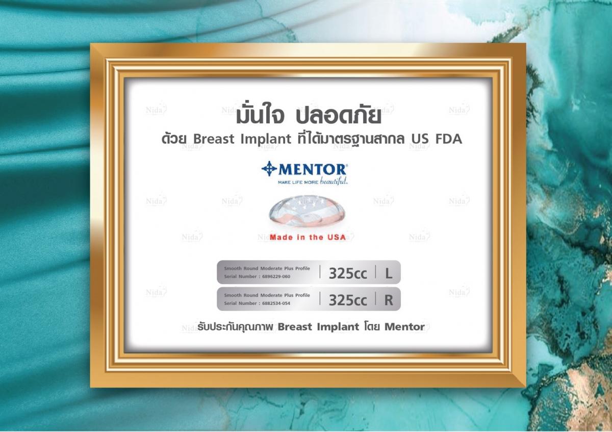 Ultimate Breast 360 °  Nida Esthetic Cosmetic Surgery Bangkok