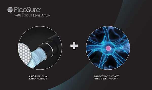 เลเซอร์ PicoSure และ Focus Lens Array