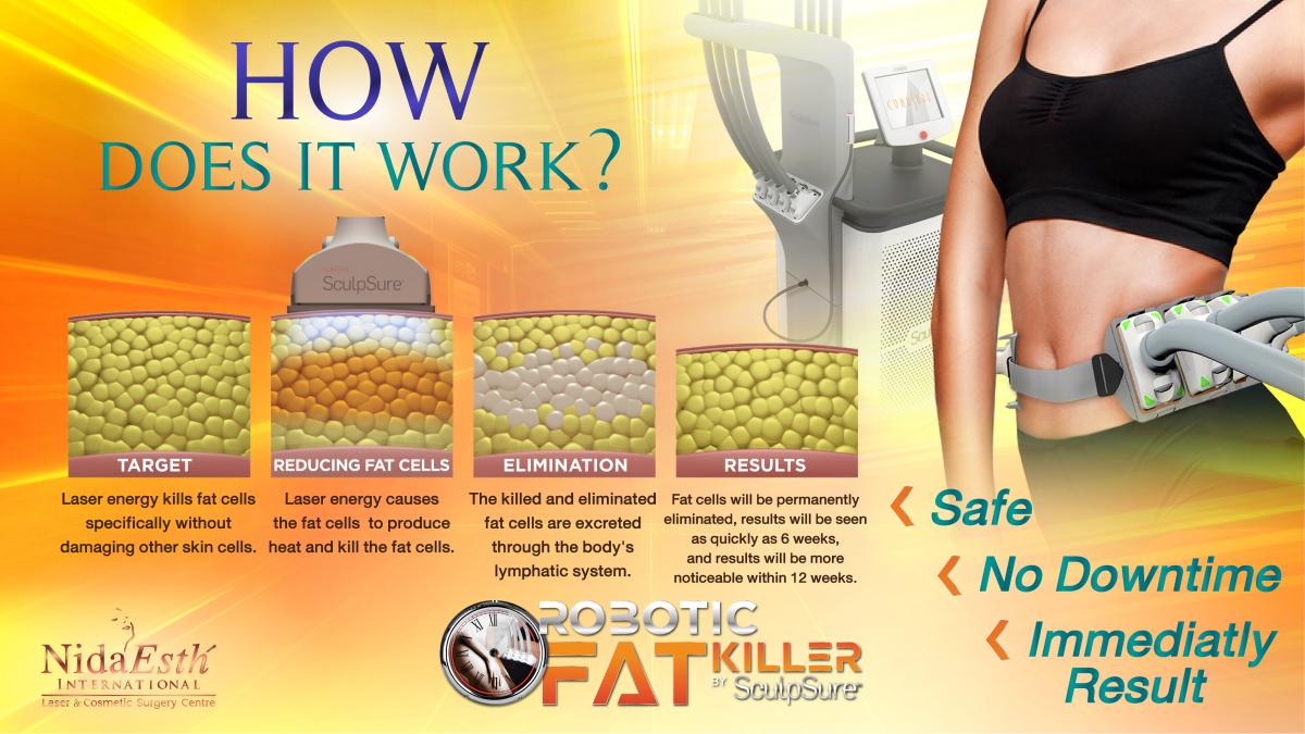 How does it work SculpSure
