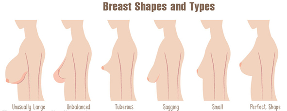 Breast Implant Primer – Round or Shaped