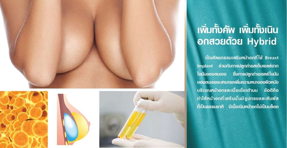 Should breast augmentation with nano chip bags?